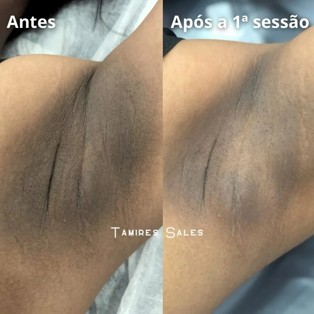 Resultado 2