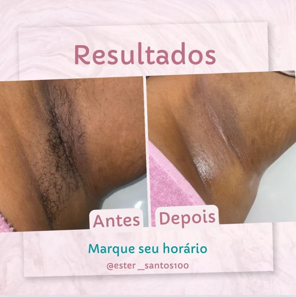 Resultado 17